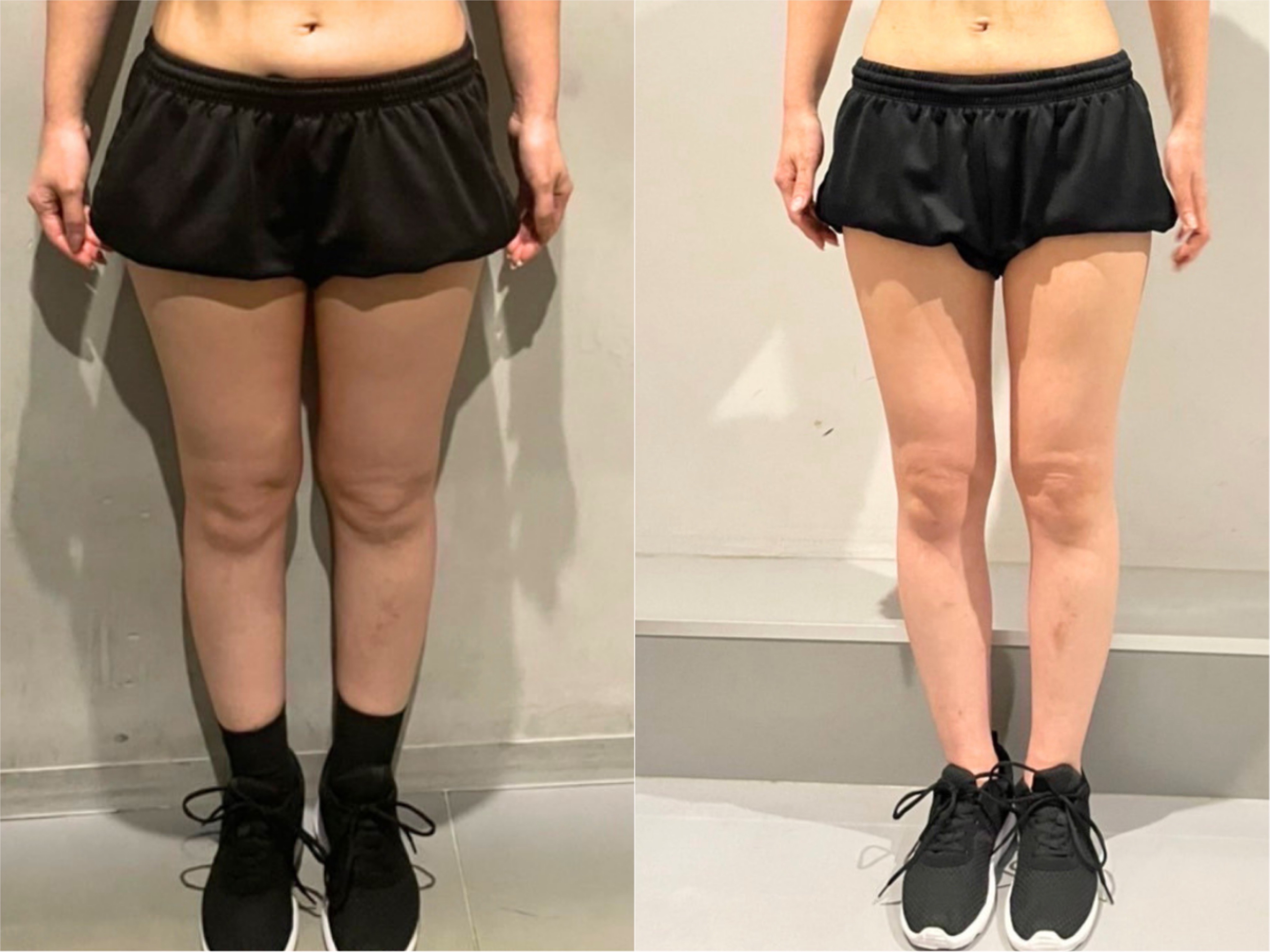 ダイエット実績24